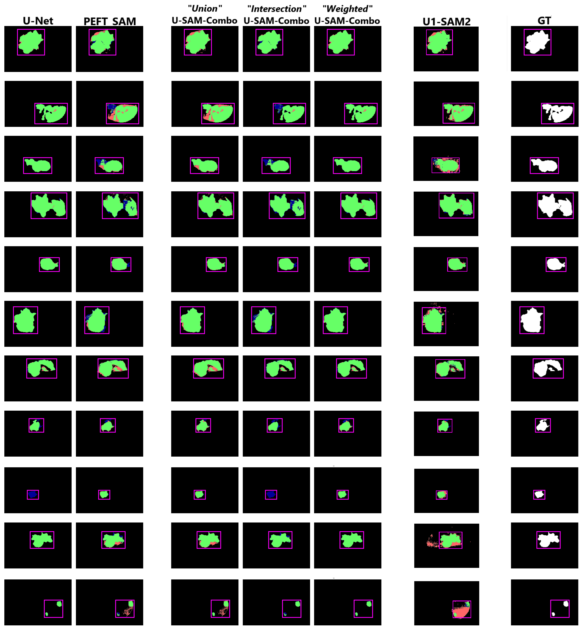 U-SAM-Combo and U1-SAM2 Visuals